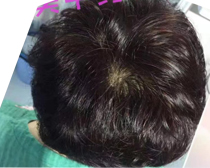 使用产品前后效果对比26