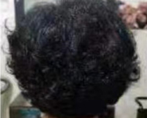 使用产品前后效果对比21