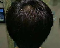 使用产品前后效果对比30