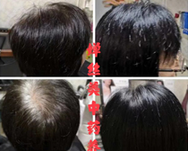 使用产品前后效果对比19