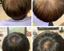 使用产品前后效果对比11