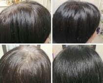 使用产品前后效果对比7